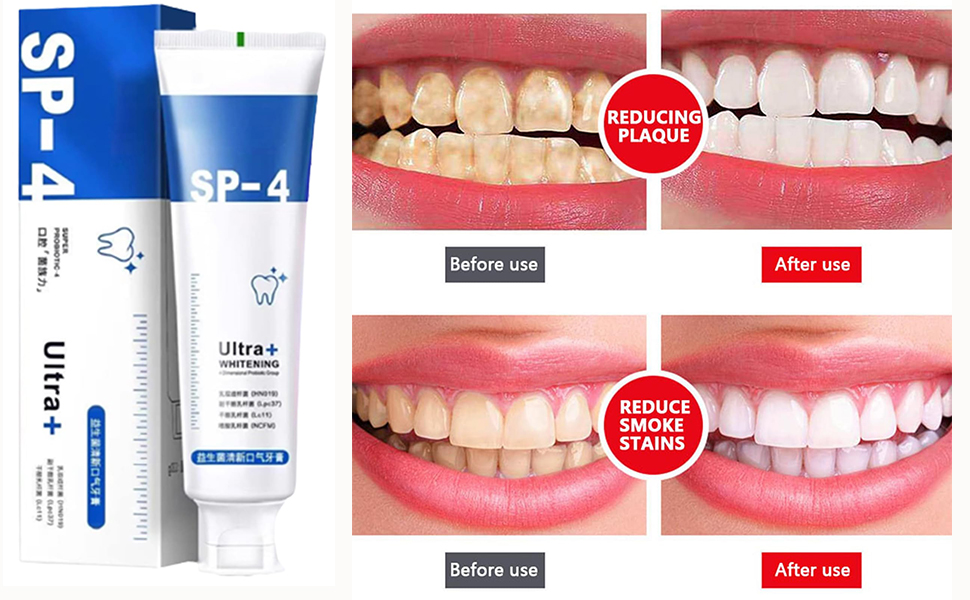 SP-4 Probiotics Whitening Toothpaste