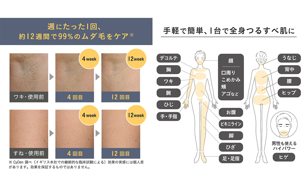 Amazon | スムーズスキン pure unplugged 家庭用脱毛器 メンズ