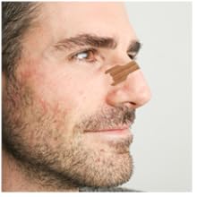 Nasal Strips 