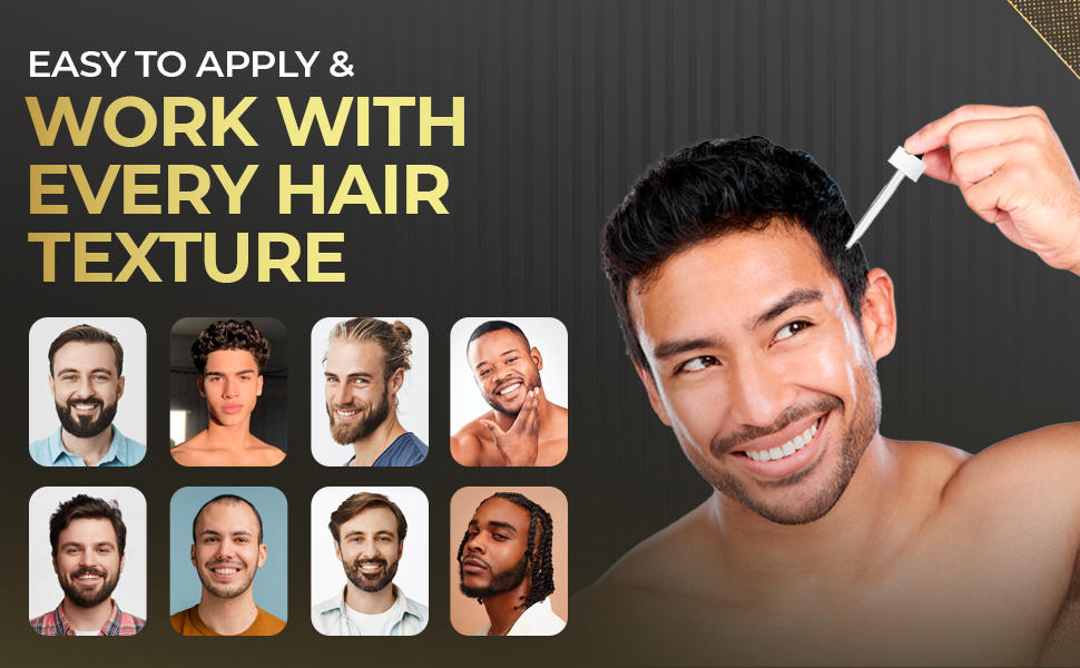 receding hairline treatment for men minoxidil para la barba