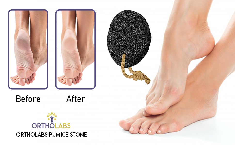 Ortholabs Pumice Stone Natural Earth Lava Pumice Stone