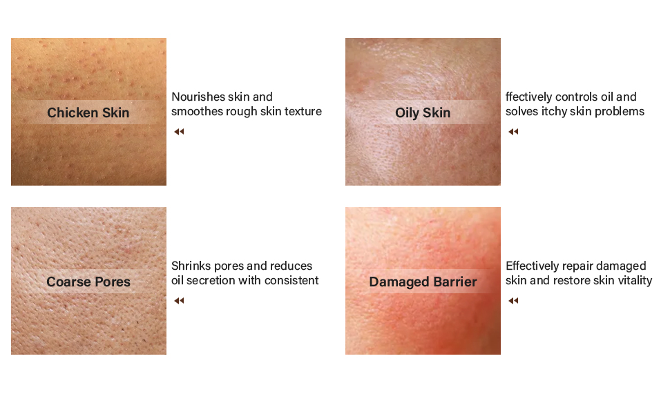Strawberry Legs Treatment for Women