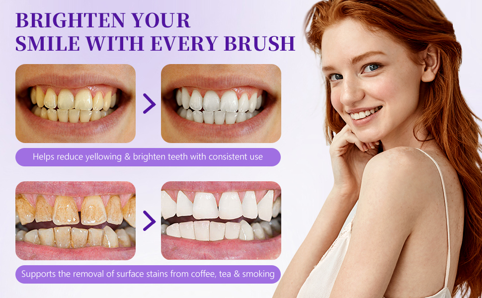 Teeth Whitening Powder
