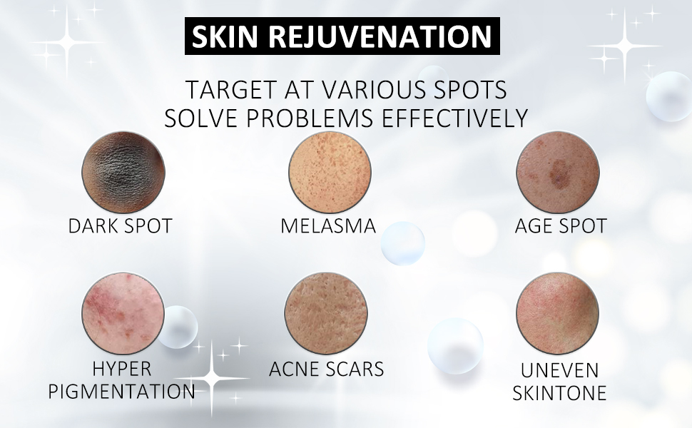 Various of Dark Spot can be removed