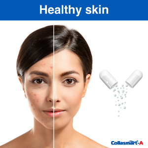 Collasmart A Type 2 Collagen