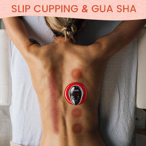 9 gear electric cupping massager heater suction cupping set guasha
