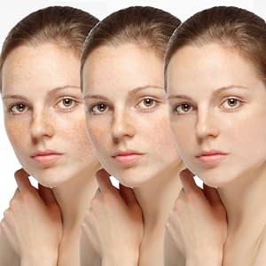 SkinDaze Extreme Dark Spot Corrector Brightening Serum Freckle Remover