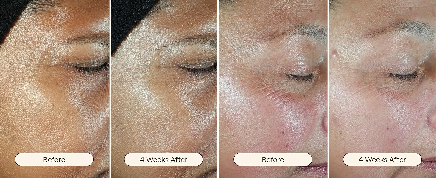 Before + Afters