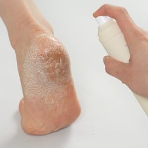  cracked heel treatment in shower scraper heels exfoliator women tool grinder removers