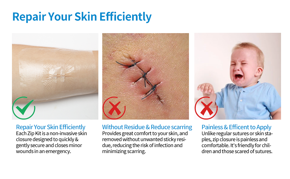 wound closure