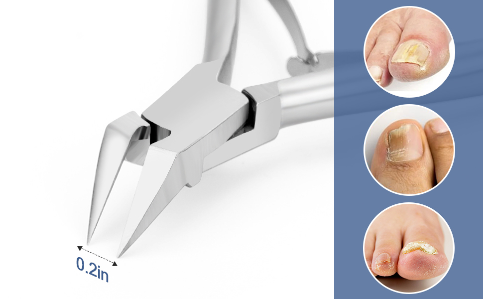  Ingrown Toenail Clippers