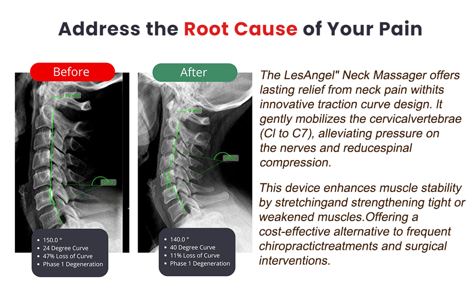 Hugterra Neck Massager