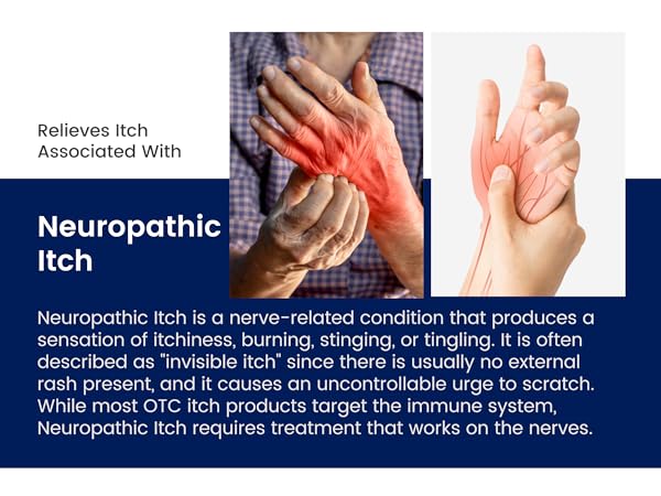 Dermeleve Anti-Itch Cream