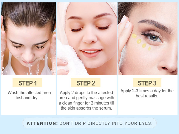 stye eye treatment