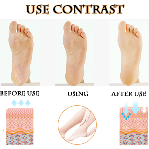 Heel Socks (2 Pair of Shocks) 4 silicon socks