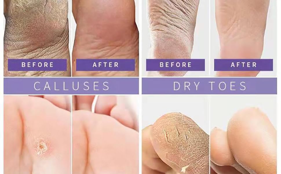 foot peel mask 3 pack