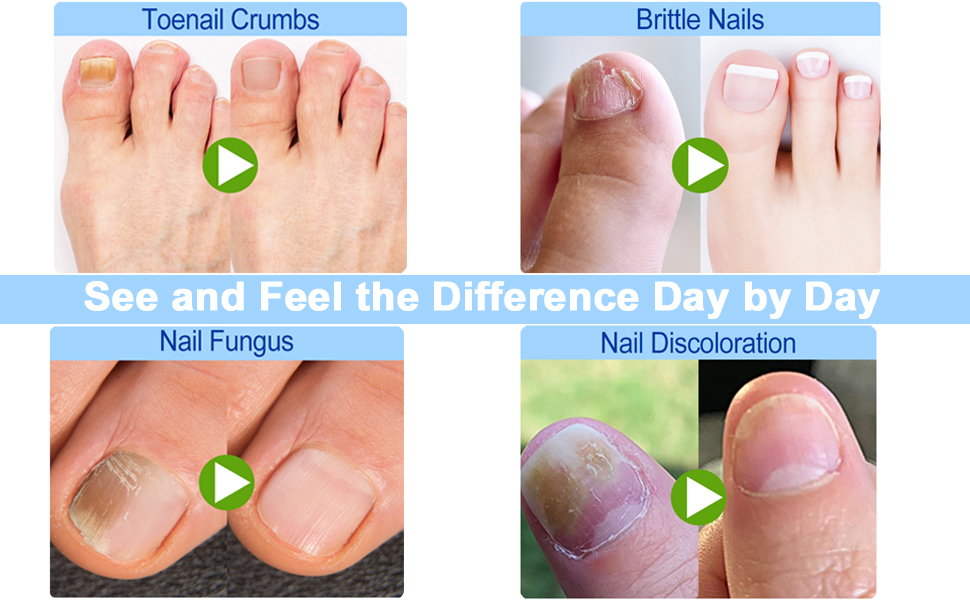 See and Feel the difference day by day