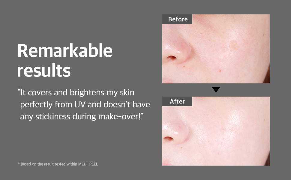 medipeel, sunscreen, sun block, suncream, skin care, korean sun cream, soothing sun, sensitive skin