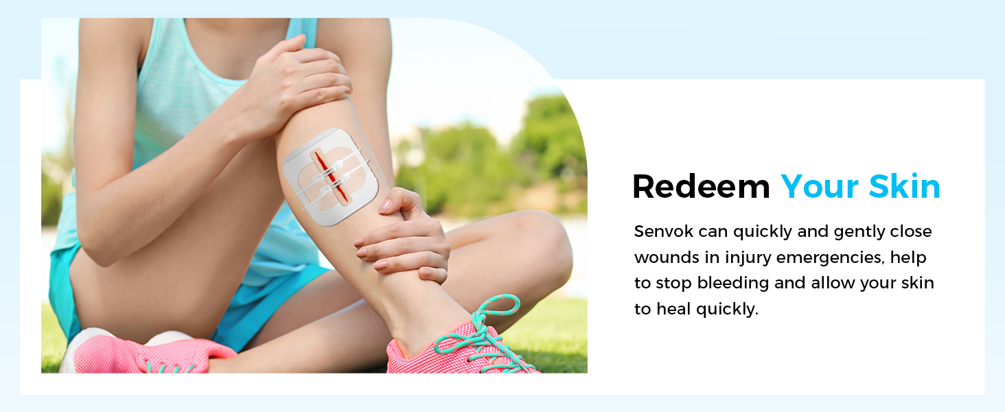 laceration closure strips