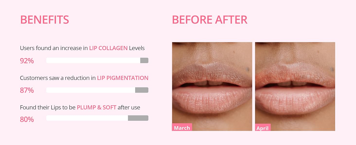 Buy ALANNA Lip Pigmentation Reduction Complete Kit for Women Dark