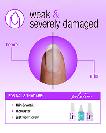 Nail Tek