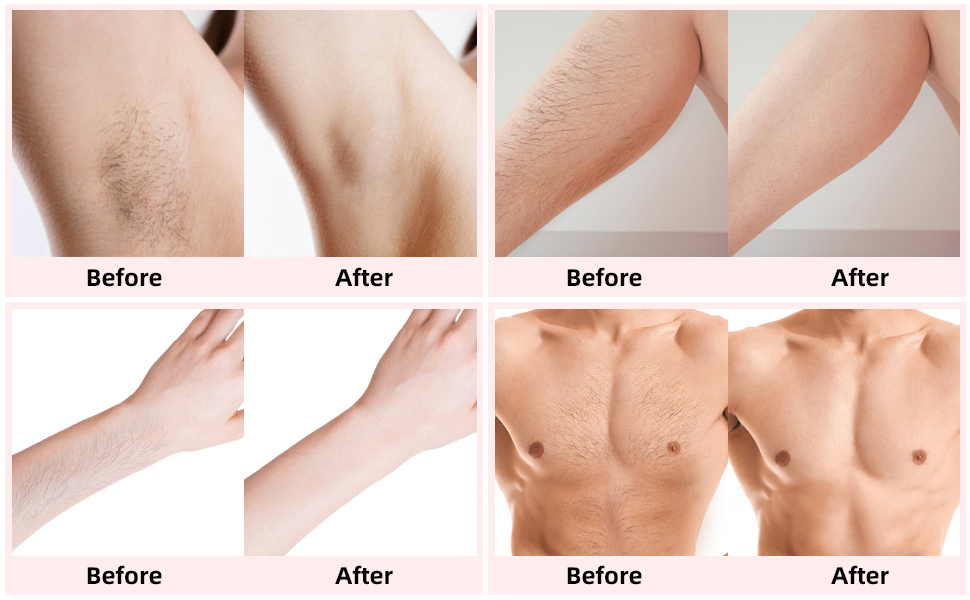 Waxing Kit Hair Removal