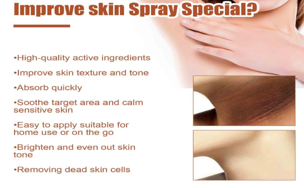 acanthosis nigricans 