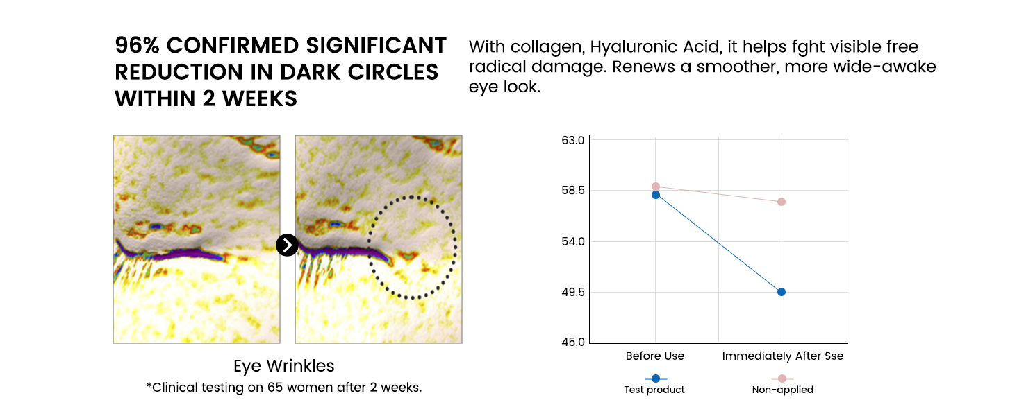 Retinol Eye Cream for Dark Circles