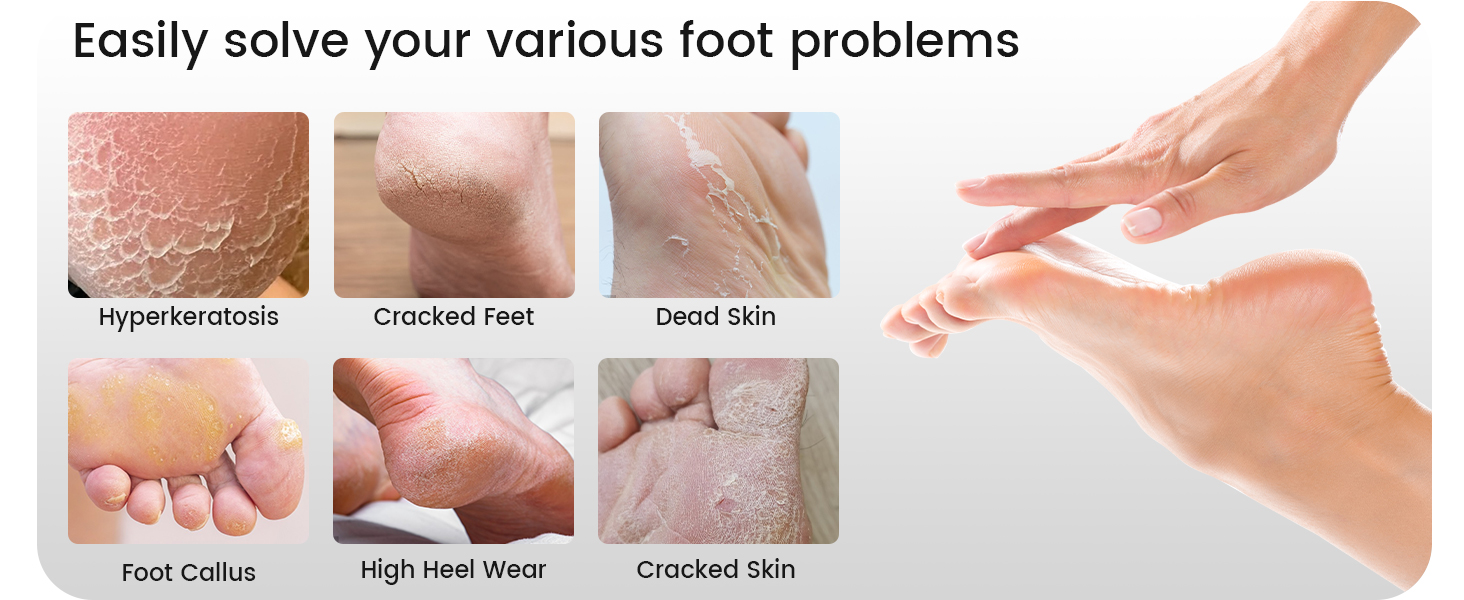 feet scrubber dead skin heel scraper for cracked heels foot scraper foot file callus remover