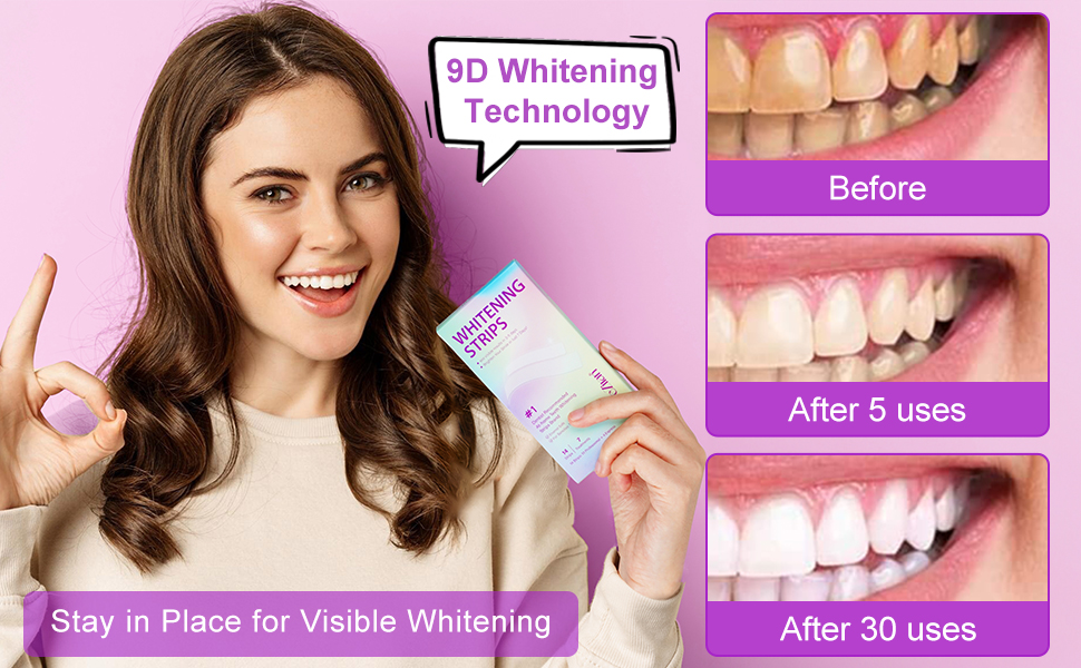Teeth Whitening Strips