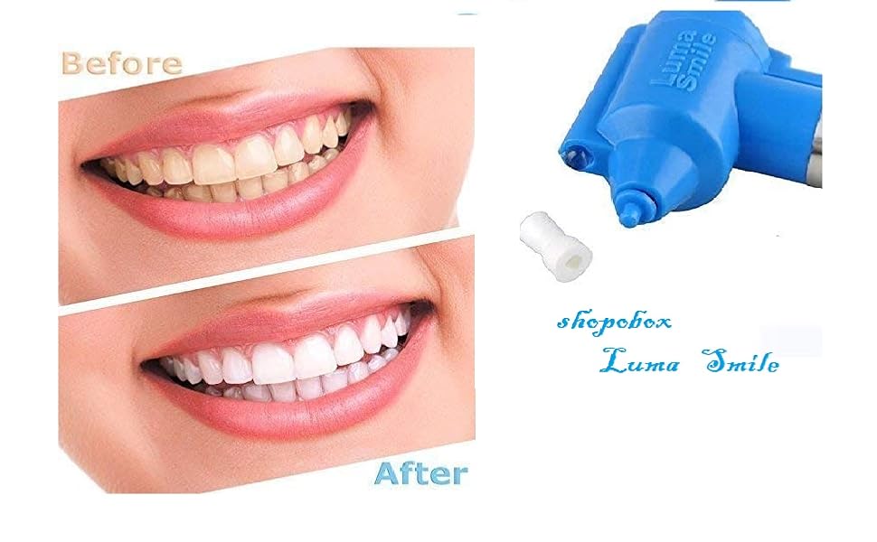 Shopobox Tooth Polisher Cleaner Whitener and Tooth Stain Remover