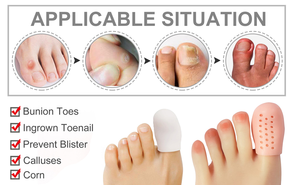 Silicone Gel Toe Cap,Gel Toe Covers,10 Pack Big Toe Protectors to Provide Relief