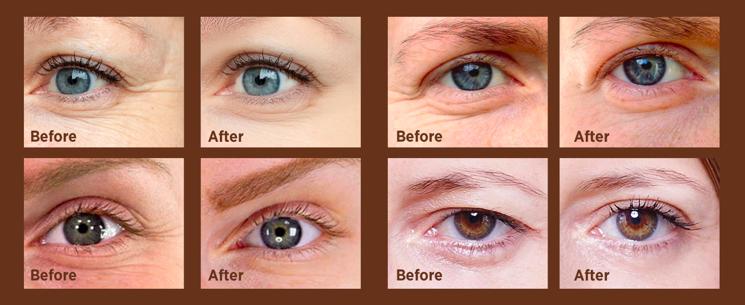 VELAMO ADVANCED Caffeine Eye Cream: for Dark Circles Puffiness Under Eye Bags Wrinkles A+ M5