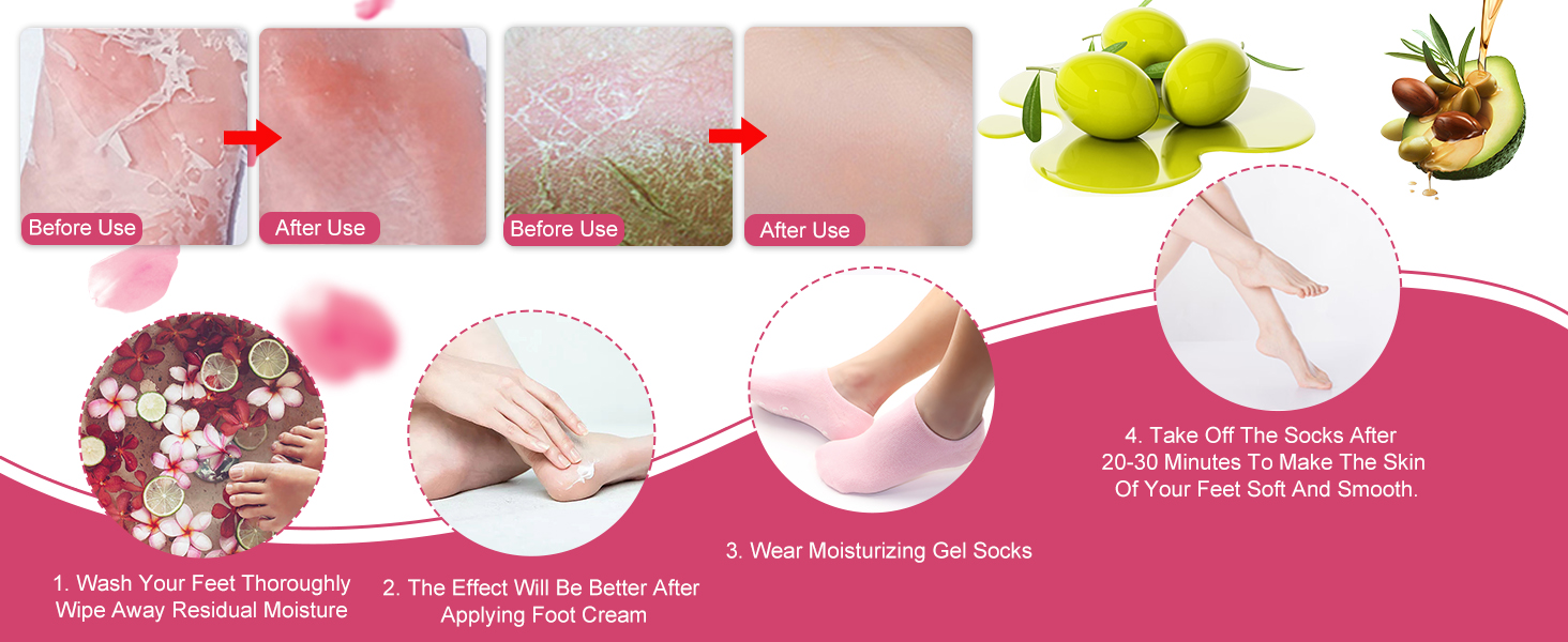 Moisturizing Socks