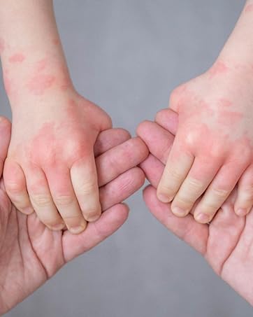 safe on all skin types and ages