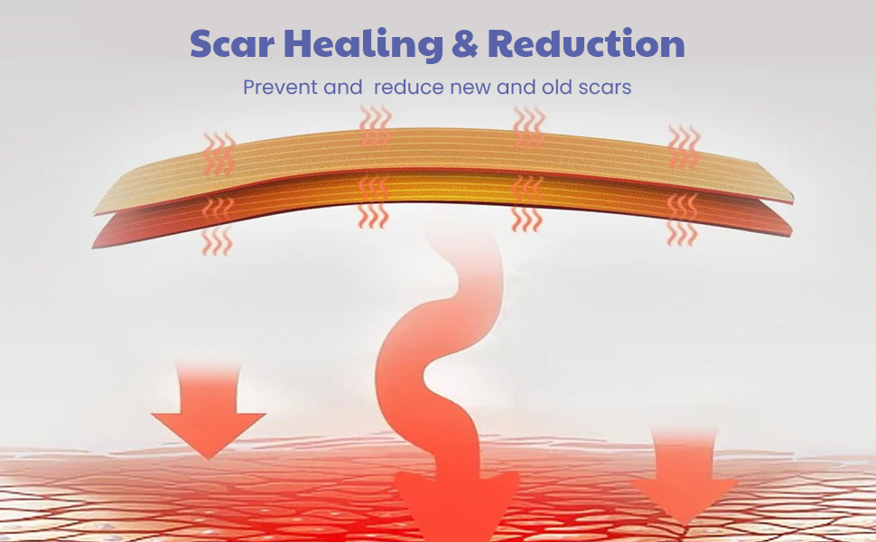 Wipness Silicone Scar Sheets