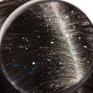 silicone scalp massager shampoo brush hair scrubber styling tools & appliances growth head scrub 