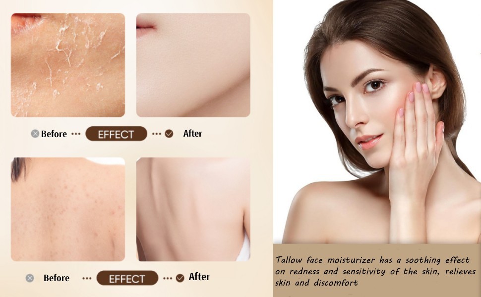 Tallow Cream, Beef Tallow And Honey Balm For Face