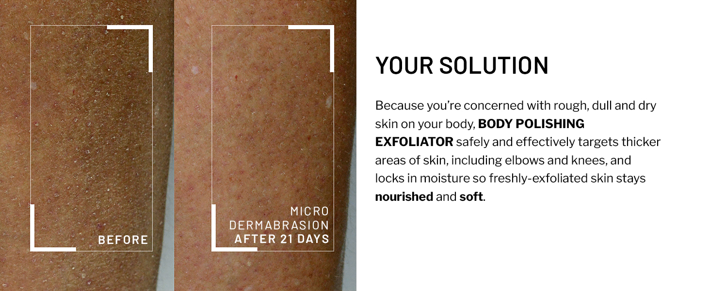 cell products gel keratosis pilaris exfoliation treatments wash doctor rough dark poredermabrasion