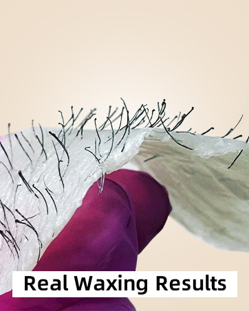 EFFECTIVE HAIR REMOVAL RESULT