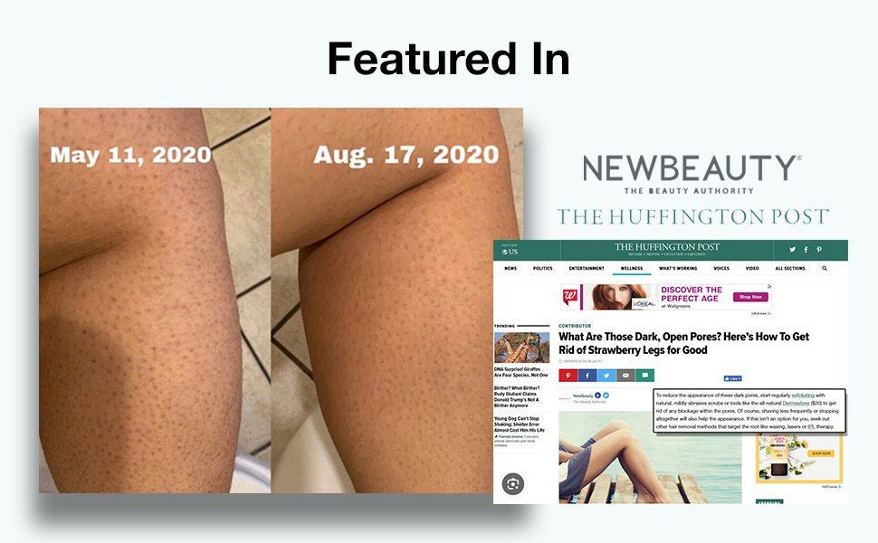 Dermastone Keratosis Pilaris Treatment Scrub for Legs Skin