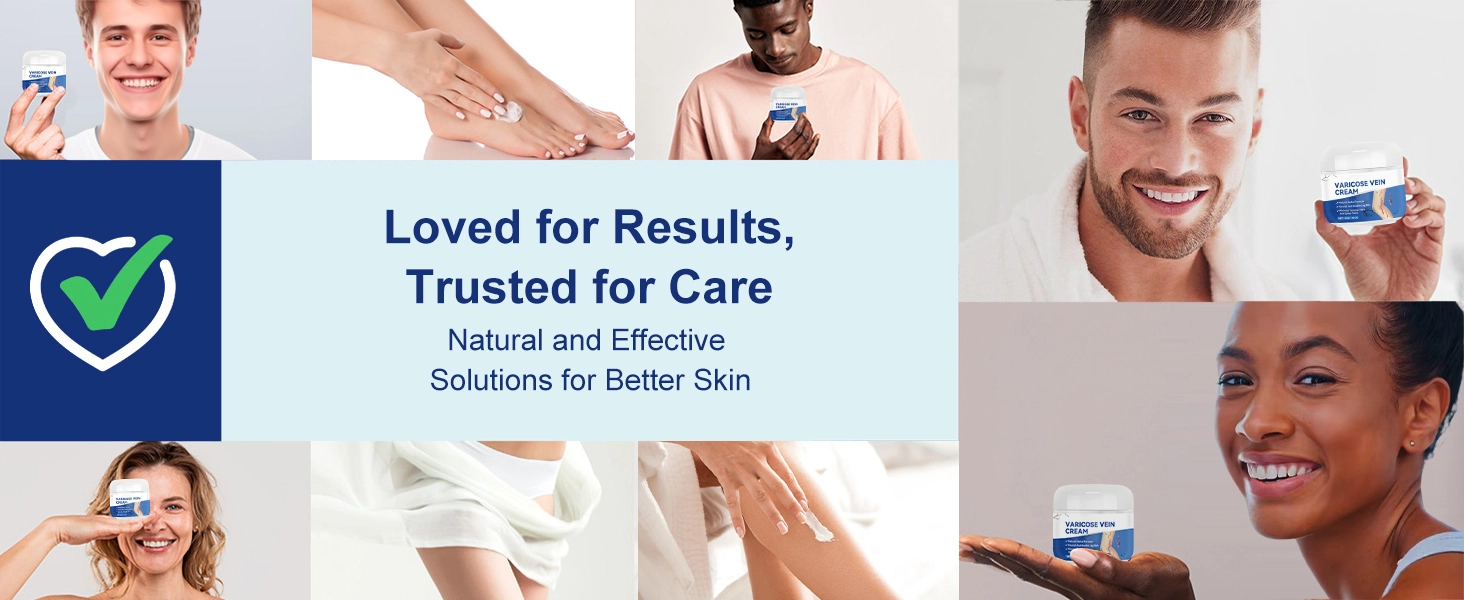 cream for varicose veins