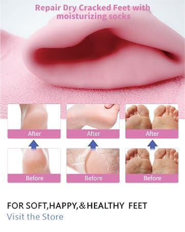 silicone socks for women