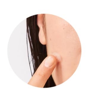 sos-pimplepatches-05