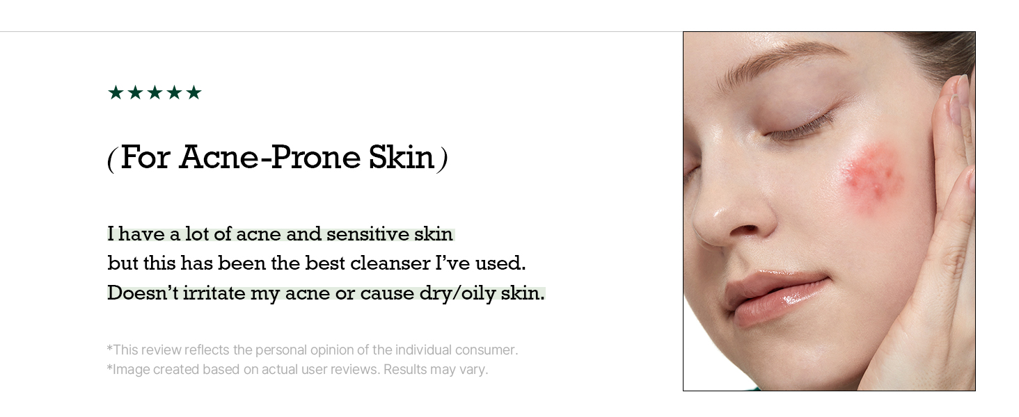 cleasner face wash, cleasner for oily skin, cleanser korean skincare, cleanser for acne prone skin