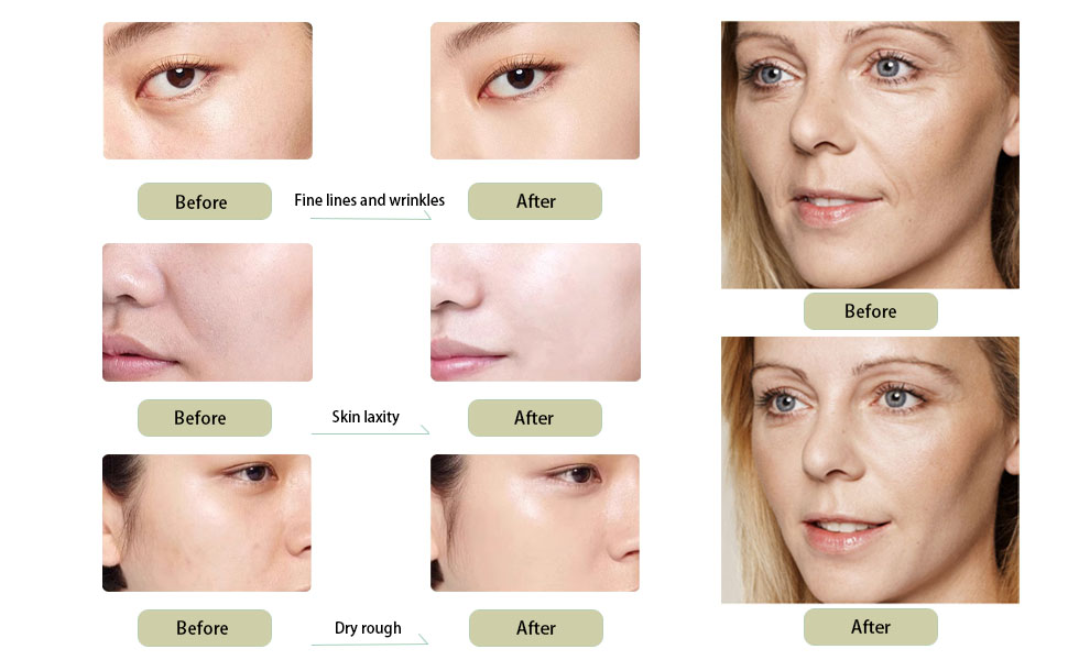 reduce fine lines and wrinkles