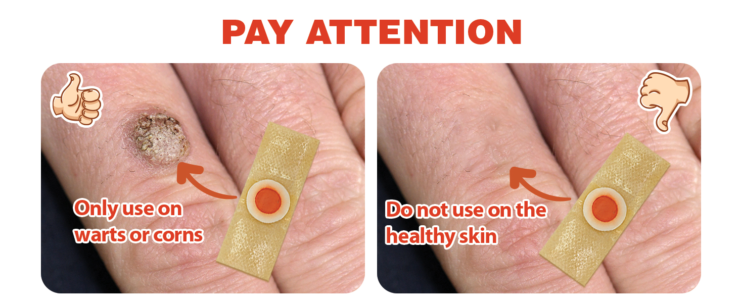 Wart Remover Bandaid FDARegistered Potent Solution for