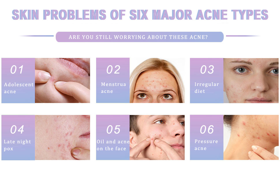 pimple patches for face