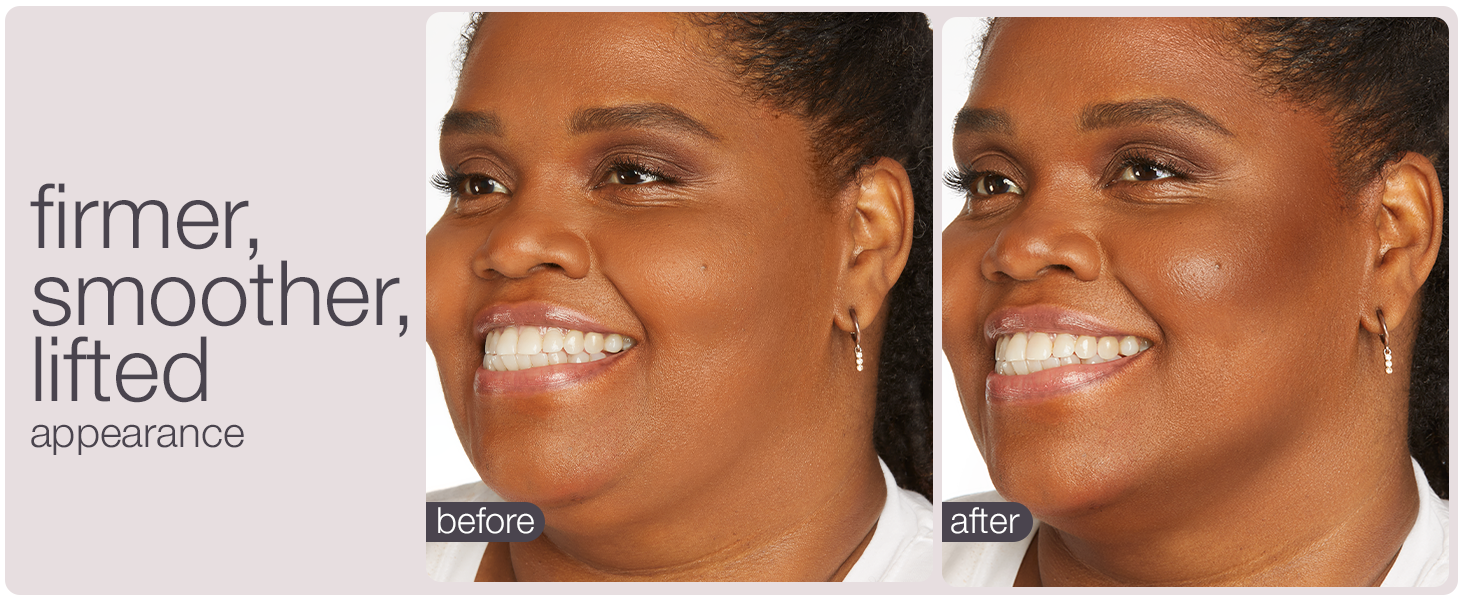 firmer smoother lifted apperance