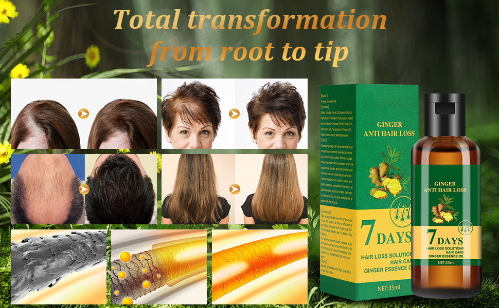 A Complete Transformation From Root To Tip With Ginger Hair Oil
